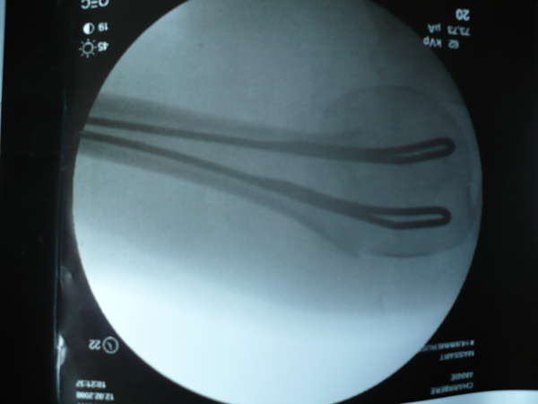 fichier 20080213_080000_0966-0.jpg